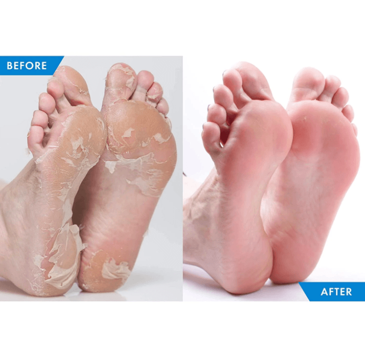 Chaussettes exfoliantes peeling (1 paire) - FOOTSTEPS